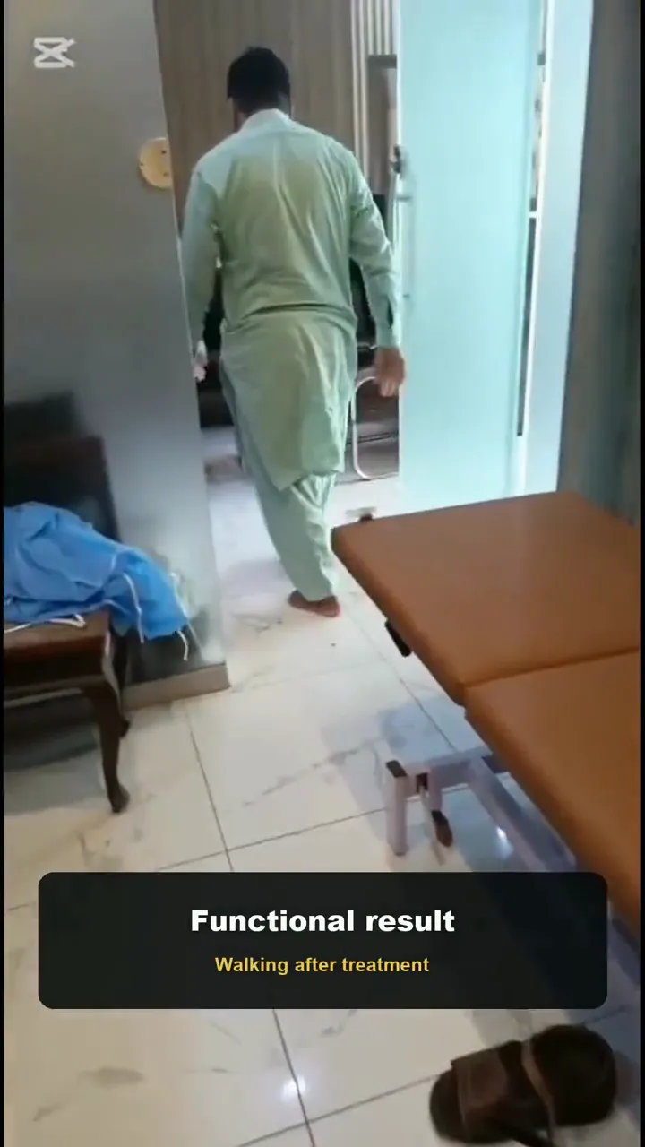 Short video of a foot wound case: the wound on the sole, the patient at a follow-up visit, walking around the clinic room and a check of the healed foot
